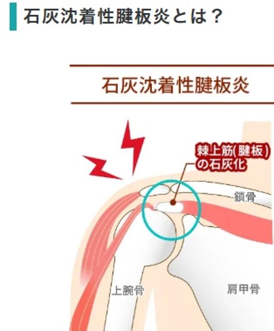右肩